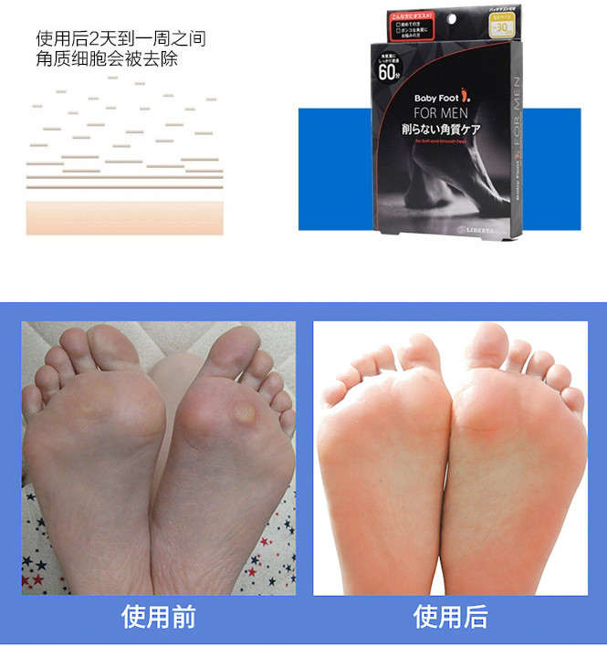 babyfoot 日本去死皮足膜男款足膜3d男士美脚足膜