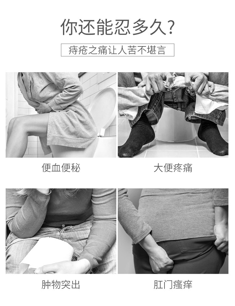 家庭医生痔疮膏消肉球痔疮凝胶女男内外痔肛裂混合痔疮栓清洗止痒