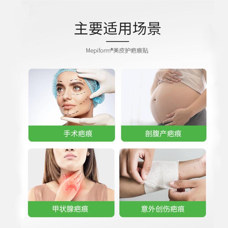 美皮护 术后疤痕护理新旧增生性肿瘤性疤克新愈合疤痕自由裁剪疤痕贴1片