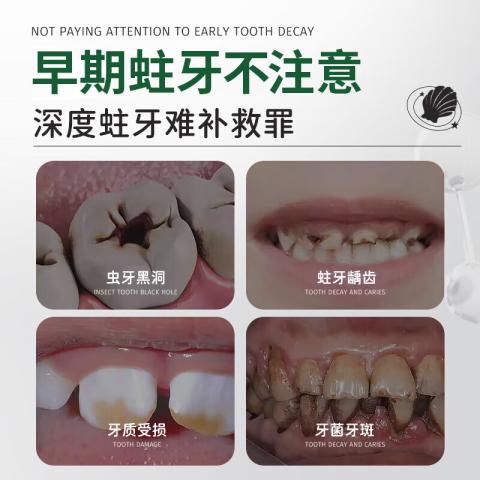 Poemoon 美白牙膏超白去黄牙渍抛光 去牙垢护牙龈 专攻牙黄/牙渍/口臭 图片 7