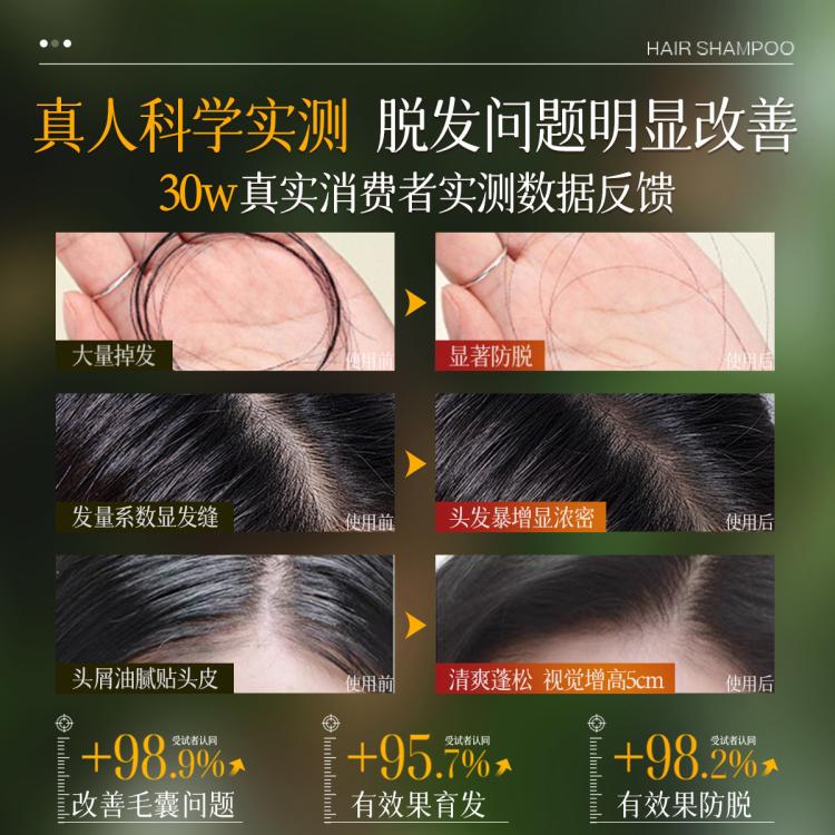 YE RENTANG 进口生姜洗发水防掉发防脱育发控油蓬松去屑止痒洗头膏洗发露女士