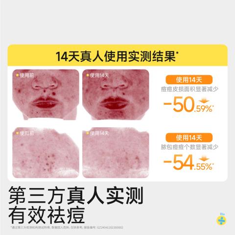 润本 【青少年洁面乳】控油祛痘青春期清洁祛黑头学生洗面奶国庆出游 图片 7