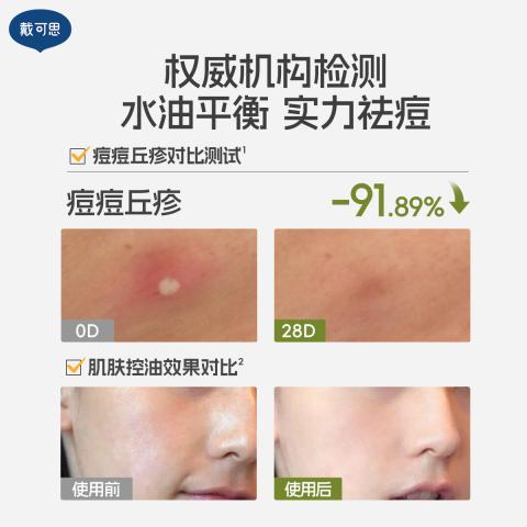戴·可·思 【青少年护肤2.0】控油祛痘洗面奶水乳精华男女学生青春期套装 图片 8