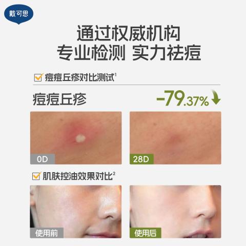 戴·可·思 【青少年护肤2.0】控油祛痘洗面奶水乳精华男女学生青春期套装 图片 8