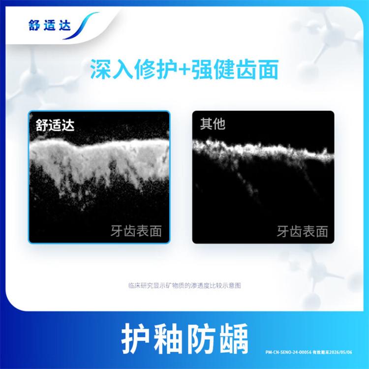 舒适达 【护齿联盟】舒缓牙齿敏感牙膏3重多效护理修护牙釉质清新口气！